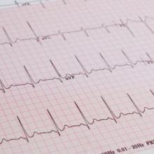 Restoring Heart Rhythm
